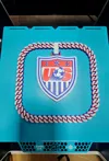 0.2mm layer, 3 walls, 8% infill with Ring no chain
