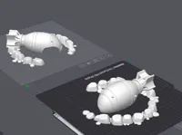 0.16mm layer, 2 walls, 15% infill