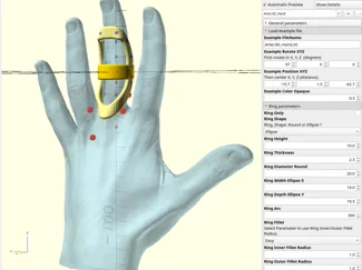 Ring only or, finger or thumb splint