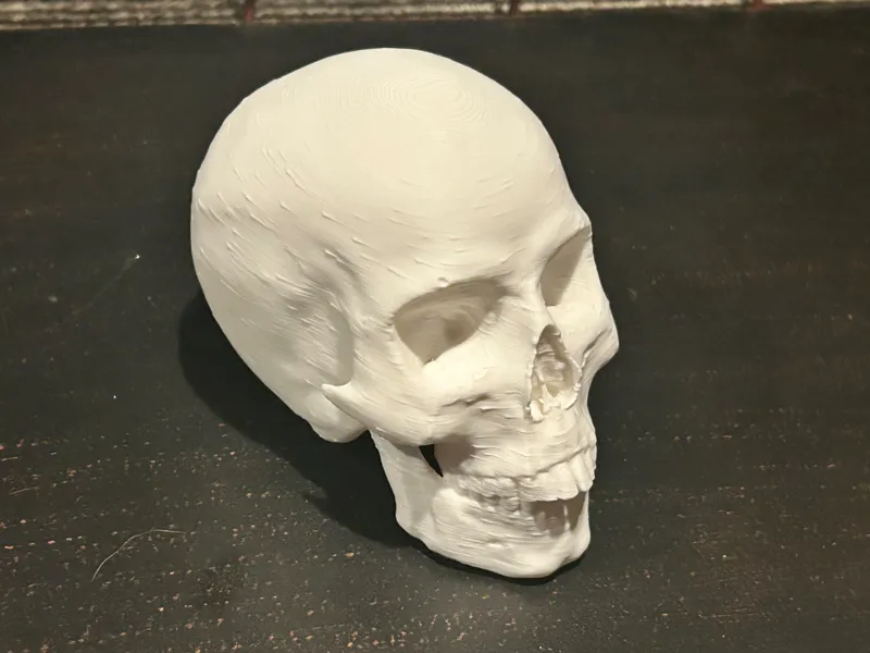 Human skull