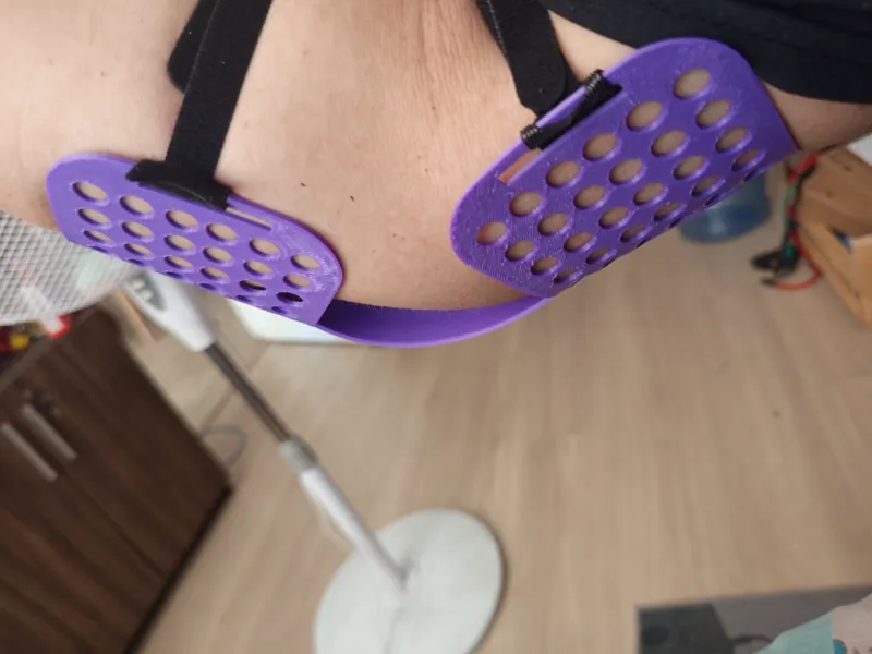 Férula de Codo Termoformable Personalizada