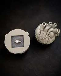 0.2mm layer, 2 walls, 75% infill