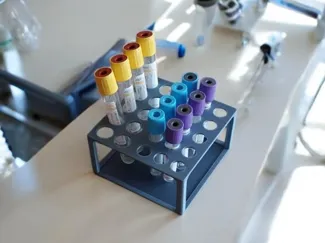 Ultimate Test Tube Rack
