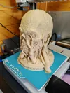 0.2mm layer, 2 walls, 7% infill