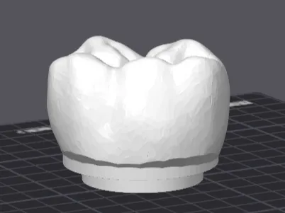 Bouchon 40mm dent
