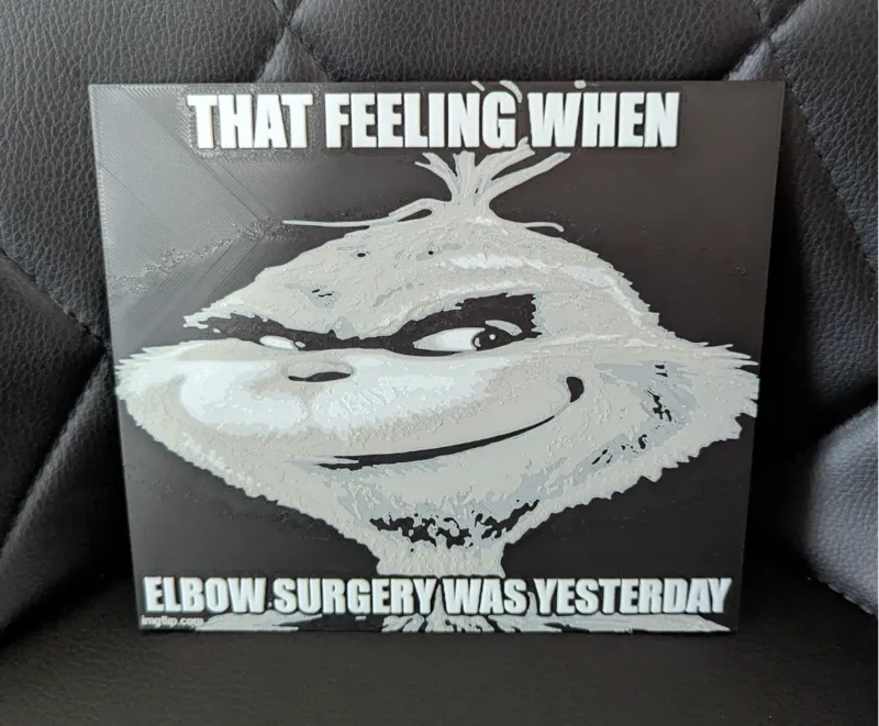 that feeling when elbow surgery was yesterday