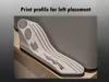 Left placement - 0.2mm layer, 2 walls