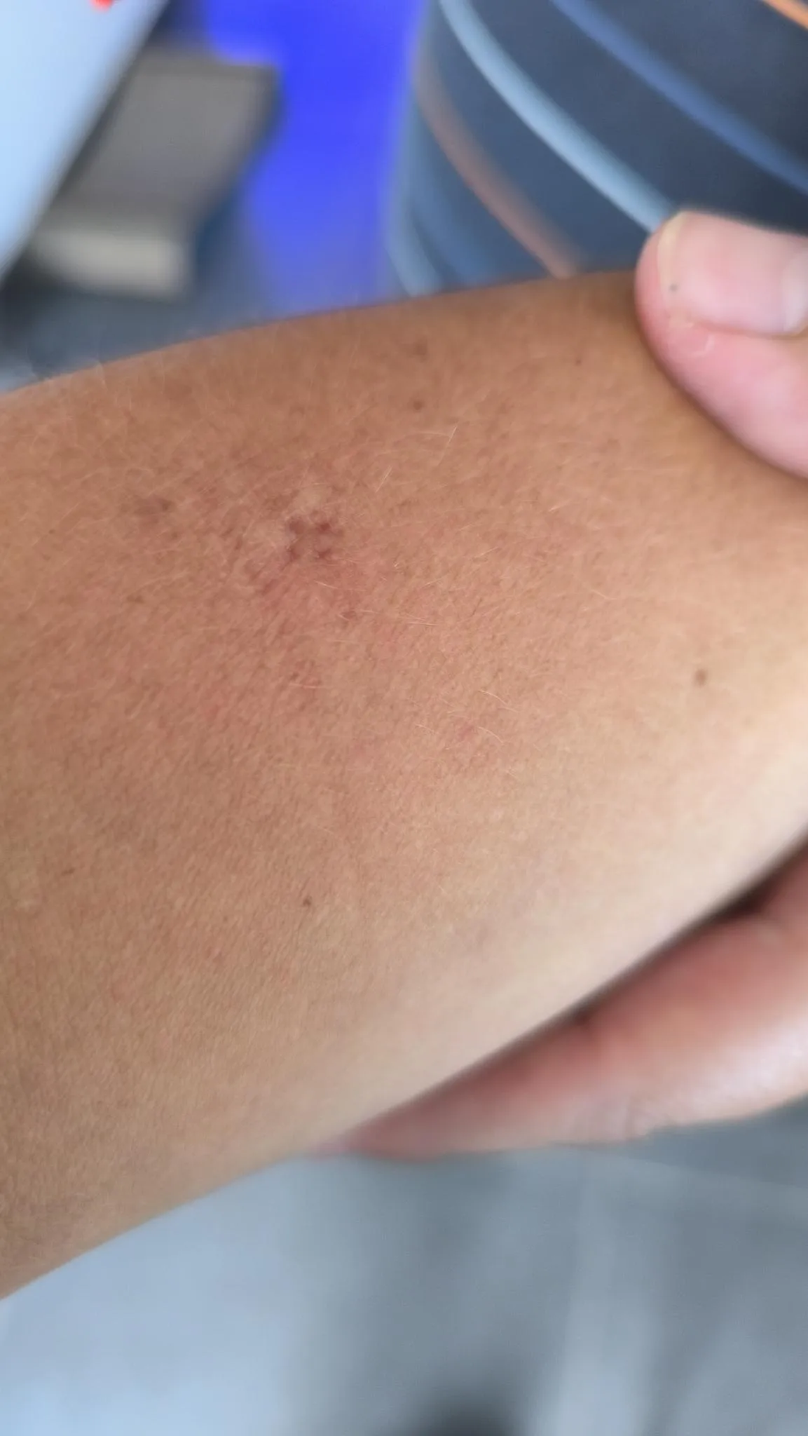 MOSQUITO BITE ITCH RELIEVER view 2