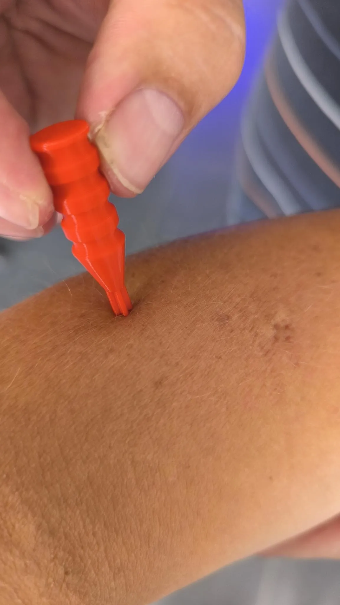 MOSQUITO BITE ITCH RELIEVER view 3