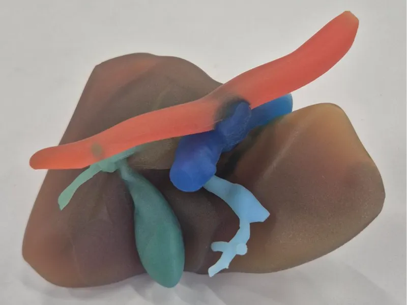 Real Liver Anatomy