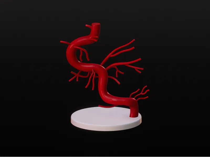 Internal Carotid Artery and Its Branches