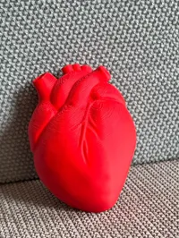 0.2mm layer, 2 walls, 10% infill