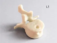 0.20mm layer, 2 walls, 15% infill