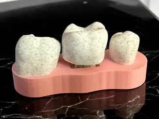Tooth Desk Fidget Clicker