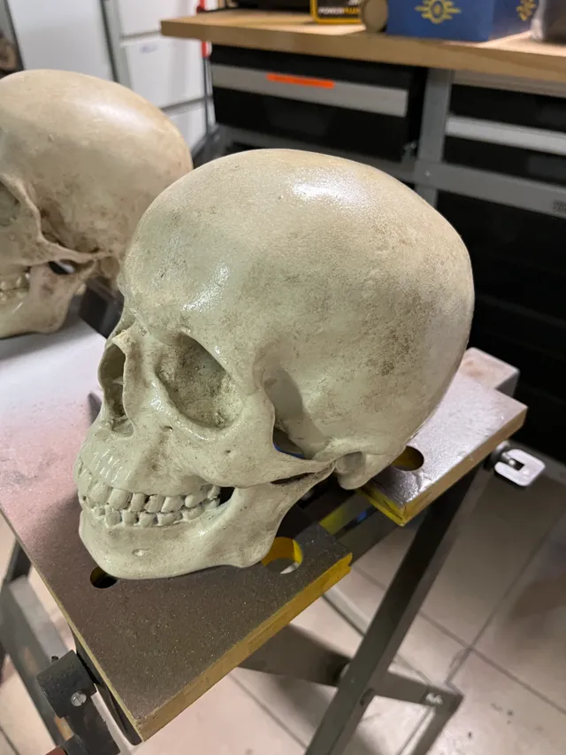 HUMAN SKULL - MEDICAL SCAN | CRÂNE HUMAIN