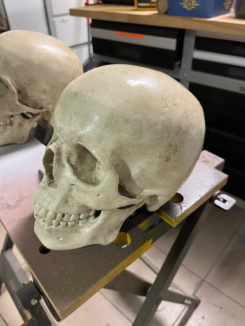 HUMAN SKULL - MEDICAL SCAN | CRÂNE HUMAIN