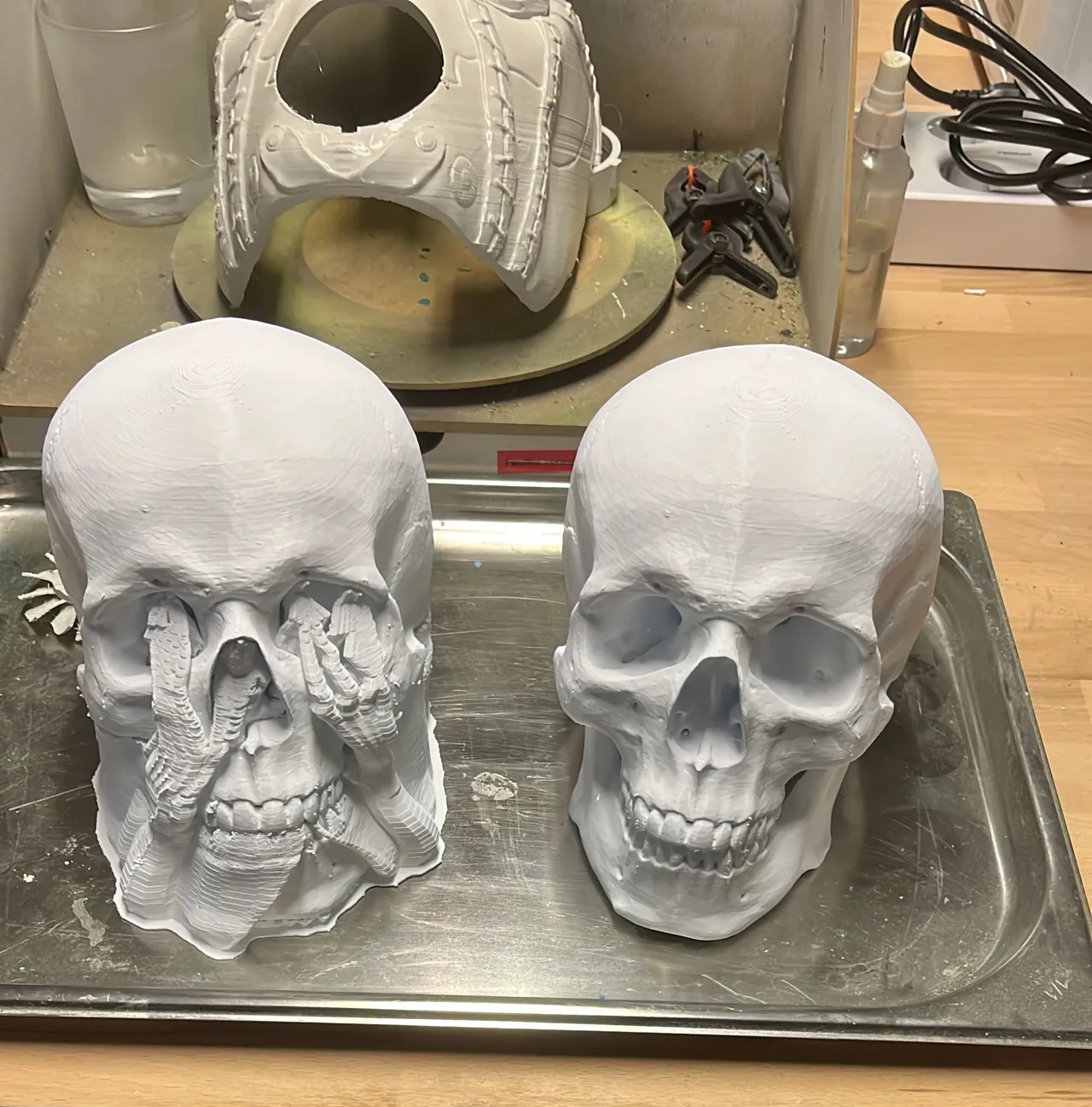 HUMAN SKULL - MEDICAL SCAN | CRÂNE HUMAIN view 3