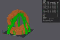 0.2mm layer, 2 walls, 7% infill