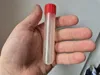 0.2mm layer, 2 walls, 25% infill