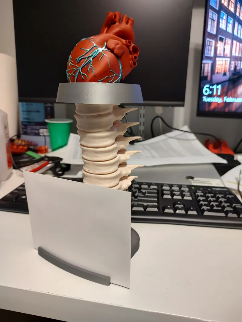 Cardiac Picture Frame