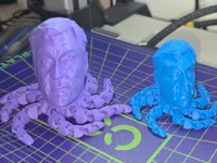 0.2mm layer, 3 walls, 15% infill