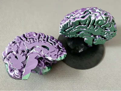 High-precision brain model: real data sagittal section