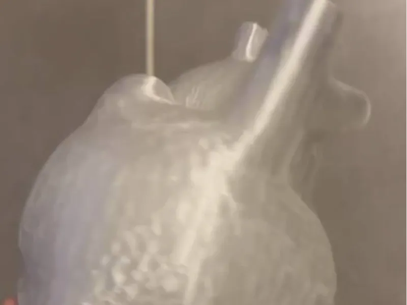 heart