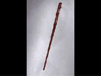 Wand 