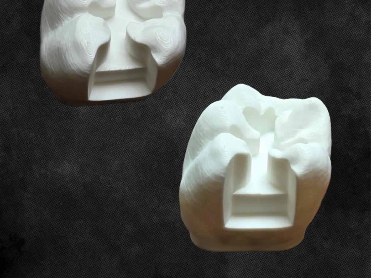 Tooth Preparation Model- Class 2 fillings (MO/MOD) - Free 3D Print ...