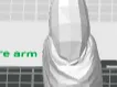 Demo højre arm