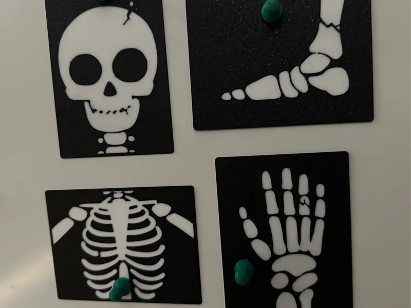 X-Ray Film Toy for Kids Doctor Play