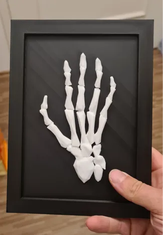 Skeletal hand