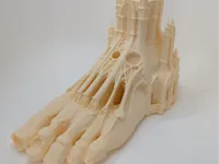 0.2mm nozzle, 0.1mm layer, 4 walls, 8% infill