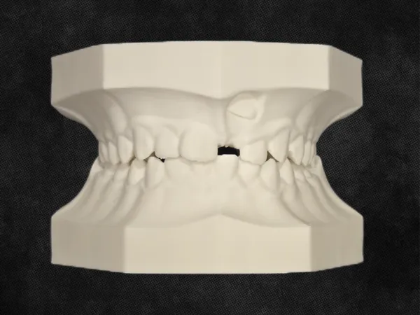 https://makerworld.bblmw.com/makerworld/model/USe3a8c0c28301a7/design/2025-05-28_ed9a2e7998228.png