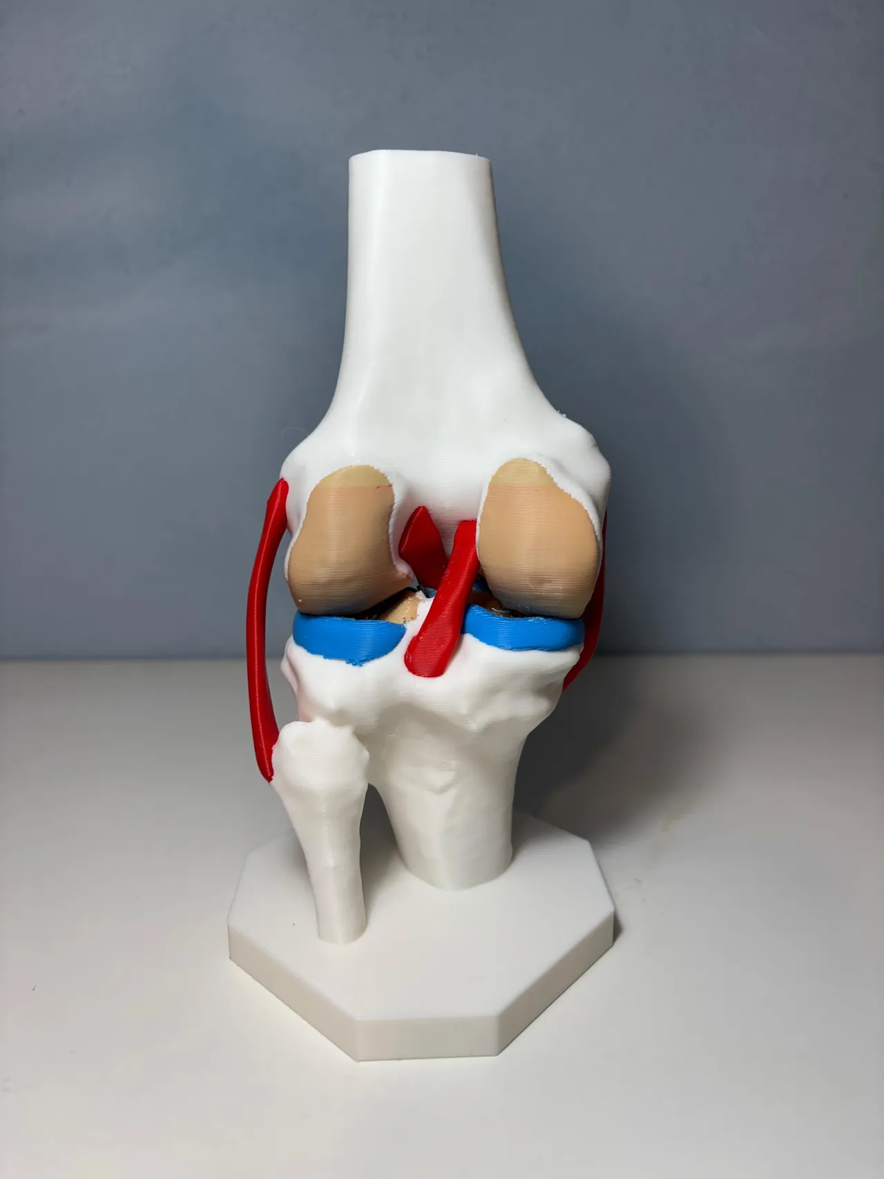 High-Precision Anatomical Knee Joint (CT scan) view 3