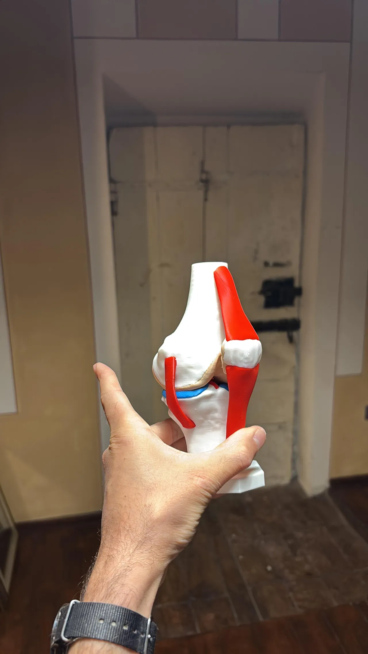 High-Precision Anatomical Knee Joint (CT scan) view 4