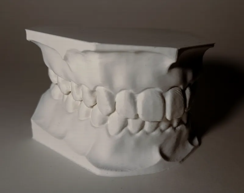 Dental Model - upper and lower teeth set
