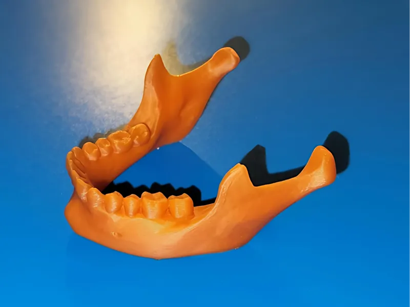 Human Mandible (Jaw Bone)