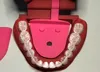 lower tongue base with pins