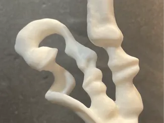 The Kiss