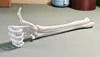 0.2mm layer, 3 walls, 15% infill