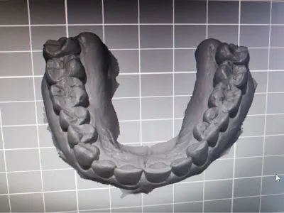 educational upper arch