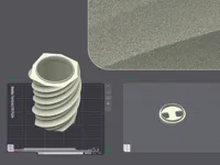 0.2mm layer, 2 walls, 10% infill
