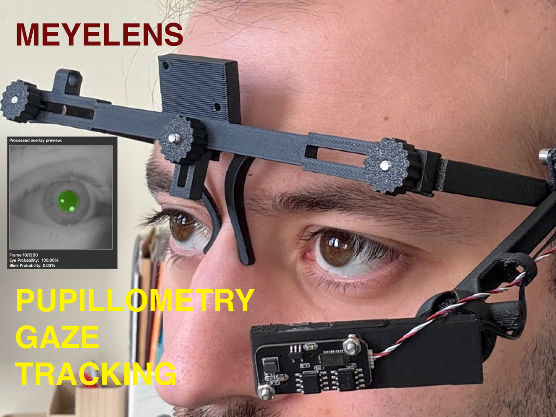 MEYELens: 3D Printed Pupillometry - Gaze Tracking