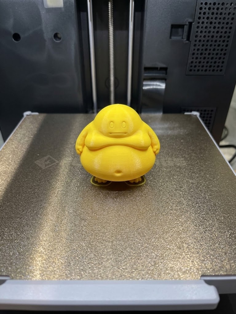 Verity Obesity (Sad) - 1