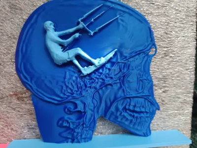 kiterbrain