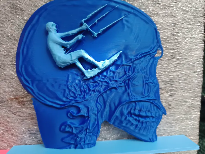 kiterbrain