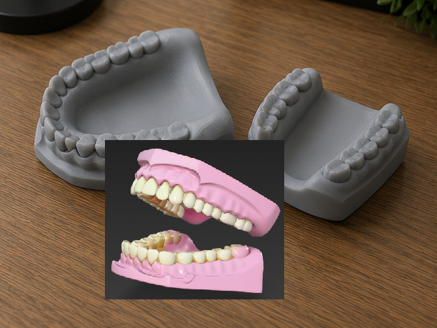 Dental Jaw Model Set | Professional Dentistry 