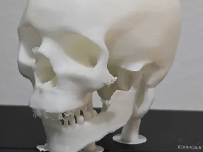 Skull