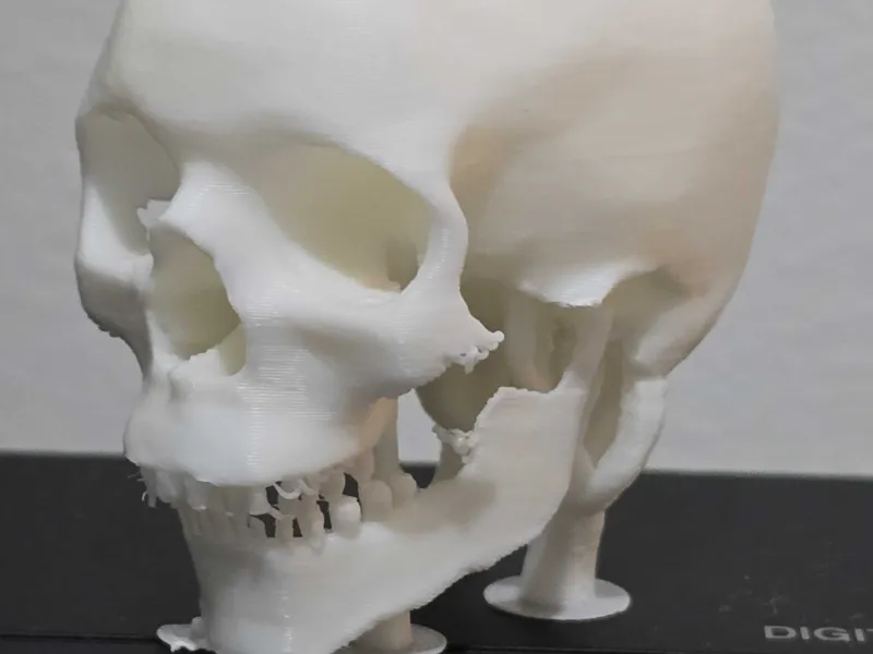 Skull